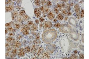 Immunoperoxidase of monoclonal antibody to RHCG on formalin-fixed paraffin-embedded human salivary gland.
