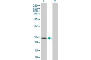 Western Blot analysis of SPA17 expression in transfected 293T cell line by SPA17 MaxPab polyclonal antibody. (SPA17 Antikörper  (AA 1-151))