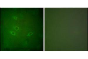 Immunofluorescence analysis of HeLa cells, using CARD6 antibody.