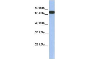 WB Suggested Anti-GNL3L Antibody Titration: 0. (GNL3L Antikörper  (N-Term))