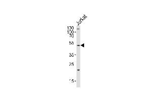 Western blot analysis of lysate from Jurkat cell line, using GAA Antibody at 1:2000. (GAA Antikörper  (N-Term))