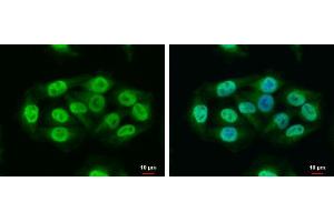 ICC/IF Image RAP1 antibody [N2C3] detects RAP1 protein at nucleus and cytoplasm by immunofluorescent analysis. (RAP1 Antikörper  (Center))