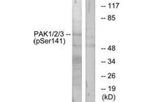 Western blot analysis of extracts from mouse brain, using PAK1/2/3 (Phospho-Ser144/141/139) Antibody. (PAK1/2/3 Antikörper  (pSer144))