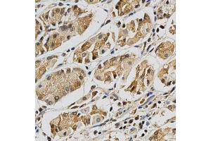 Immunohistochemistry of paraffin-embedded human stomach using LGALS3 antibody at dilution of 1:200 (x400 lens) (Galectin 3 Antikörper  (AA 1-250))