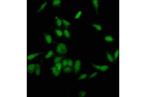 Immunofluorescence staining of Hela cells with ABIN7145812 at 1:200, counter-stained with DAPI. (BRD4 Antikörper  (AA 150-200))