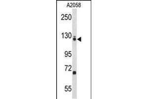 Western blot analysis of EFTUD2 Antibody (Center) (ABIN653236 and ABIN2842767) in  cell line lysates (35 μg/lane). (EFTUD2 Antikörper  (AA 257-284))