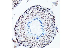 Immunohistochemistry of paraffin-embedded mouse testis using Phospho-Histone H2AX-S139 antibody (ABIN6135258, ABIN6136140, ABIN6136141 and ABIN7101881) at dilution of 1:100 (40x lens). (Histone H2A Antikörper  (pSer139))