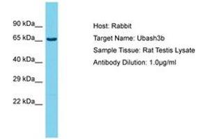Image no. 1 for anti-Cbl-Interacting Protein Sts-1 (STS1) (AA 564-613) antibody (ABIN6750419) (UBASH3B Antikörper  (AA 564-613))