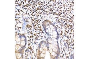 Immunohistochemistry of paraffin-embedded human small intestine using TR Rabbit mAb (ABIN7270870) at dilution of 1:200 (40x lens). (TRAPPC2 Antikörper)
