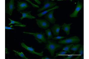 Immunofluorescence of monoclonal antibody to PAFAH1B1 on HeLa cell. (PAFAH1B1 Antikörper  (AA 1-110))