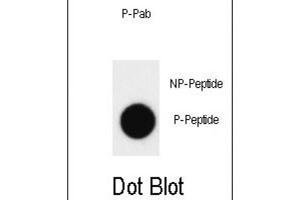 Dot Blot (DB) image for anti-C-Abl Oncogene 1, Non-Receptor tyrosine Kinase (ABL1) (pTyr412) antibody (ABIN3001744) (ABL1 Antikörper  (pTyr412))