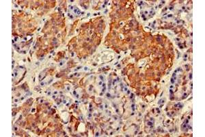 Immunohistochemistry (IHC) image for anti-GIT1 (GIT1) (AA 470-642) antibody (ABIN7144546)