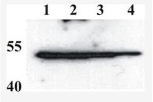 Western Blotting (WB) image for anti-BPV-1 (AA 208-218) antibody (ABIN781764) (BPV-1 (AA 208-218) Antikörper)