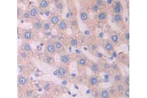 IHC-P analysis of Kidney tissue, with DAB staining. (Surfactant Protein C Antikörper  (AA 1-194))