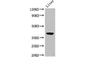 Western Blot Positive WB detected in: Rat liver tissue All lanes: ADH5 antibody at 2 μg/mL Secondary Goat polyclonal to rabbit IgG at 1/50000 dilution Predicted band size: 40 kDa Observed band size: 40 kDa (ADH5 Antikörper  (AA 14-130))