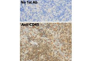 Immunohistochemistry (IHC) image for anti-Protein tyrosine Phosphatase, Receptor Type, C (PTPRC) (C-Term) antibody (ABIN6254210)