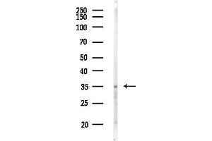 Western blot analysis of lysates from EC304 cells(UV 30 min treatment), using Phospho-Annexin  (Ser26) Antibody at 1/1000 dilution.