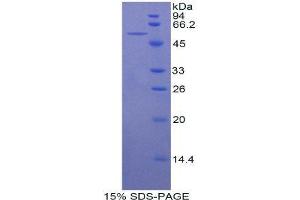 SDS-PAGE (SDS) image for Beta-secretase 1 (BACE1) (AA 190-430) protein (His tag,GST tag) (ABIN1879502)