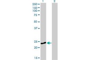 Western Blotting (WB) image for anti-RAB4A, Member RAS Oncogene Family (RAB4A) (AA 1-218) antibody (ABIN562558)