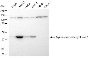 Western blotting analysis using argininosuccinate synthase 1 antibody (ABIN7797647). (ASS1 Antikörper)