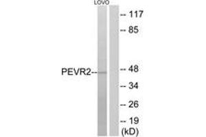 Western blot analysis of extracts from LOVO cells, using PEVR2 Antibody. (PEVR2 (AA 235-284) Antikörper)