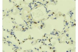 ABIN6273695 at 1/100 staining Mouse lung tissue by IHC-P. (PLCE1 Antikörper)