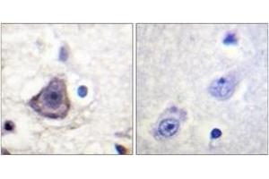 Immunohistochemistry analysis of paraffin-embedded human brain, using HER3 (Phospho-Tyr1222) Antibody. (ERBB3 Antikörper  (pTyr1222))