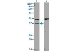 Western Blot analysis of MAPK14 expression in transfected 293T cell line by MAPK14 monoclonal antibody (M01), clone 3D5.