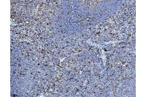 IHC analysis of P4HB using anti-P4HB antibody (ABIN7600075).