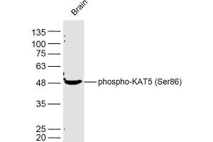 Mouse brain lysates probed with KAT5 (Ser86) Polyclonal Antibody, Unconjugated  at 1:300 dilution and 4˚C overnight incubation. (KAT5 Antikörper  (pSer86))