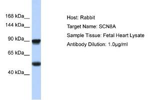 Host: Rabbit Target Name: SCN8A Sample Type: Fetal Heart lysates Antibody Dilution: 1. (SCN8A Antikörper  (C-Term))