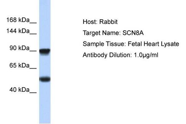 SCN8A antibody  (C-Term)