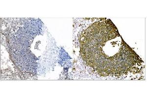 IHC analysis of IGF2R using anti-IGF2R antibody (ABIN7601706). (IGF2R Antikörper  (AA 424-529))