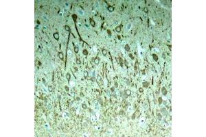 Immunohistochemistry (IHC) image for anti-Microtubule-Associated Protein tau (MAPT) (pThr231) antibody (ABIN3020352) (MAPT Antikörper  (pThr231))
