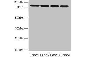 Western blot All lanes: ITGB8 antibody at 1. (ITGB8 Antikörper  (AA 43-320))