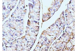 IHC analysis of Annexin VI using anti-Annexin VI antibody (ABIN7601597).
