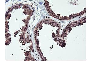Immunohistochemical staining of paraffin-embedded Human breast tissue using anti-NHEJ1 mouse monoclonal antibody. (NHEJ1 Antikörper)