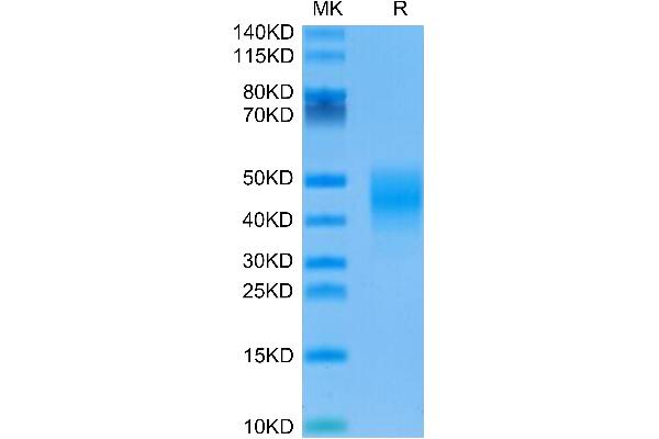 FCGR2B Protein (AA 40-217) (His tag)