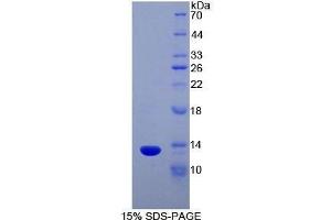 Chemokine (C Motif) Ligand 1 (XCL1) (AA 27-107) protein (His tag,T7 tag)