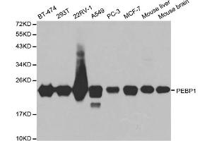 Western blot analysis of extracts of various cell lines, using PEBP1 antibody. (PEBP1 Antikörper)