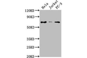 Western Blot Positive WB detected in: Hela whole cell lysate, Jurkat whole cell lysate, PC-3 whole cell lysate All lanes: PRICKLE3 antibody at 1:2000 Secondary Goat polyclonal to rabbit IgG at 1/50000 dilution Predicted band size: 69, 60 kDa Observed band size: 69 kDa (PRICKLE3 Antikörper  (AA 9-24))