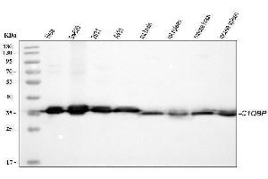 Western blot analysis of C1QBP using anti-C1QBP antibody (ABIN4886491). (C1QBP Antikörper  (AA 190-282))