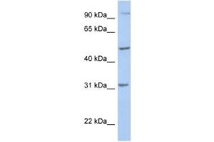 PPM1J antibody used at 1 ug/ml to detect target protein. (PPM1J Antikörper)
