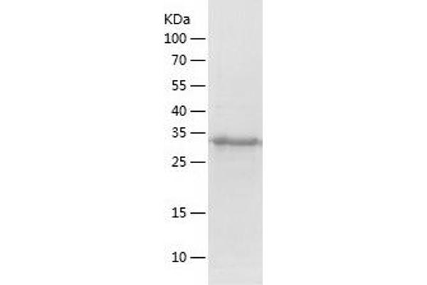 POLL Protein (AA 1-300) (His tag)