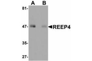 Image no. 1 for anti-Receptor Accessory Protein 4 (REEP4) (Internal Region) antibody (ABIN478105) (Receptor Accessory Protein 4 Antikörper  (Internal Region))