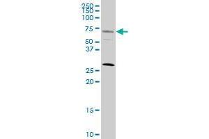 SRF monoclonal antibody (M02), clone 1C8. (SRF Antikörper  (AA 406-508))