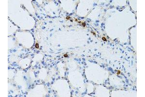 Immunohistochemistry of paraffin-embedded rat lung using TEFM antibody (ABIN5974873) at dilution of 1/100 (40x lens). (TEFM Antikörper)