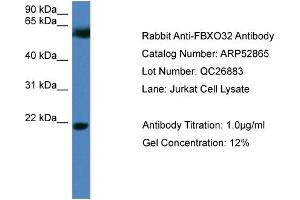WB Suggested Anti-FBXO32  Antibody Titration: 0. (FBXO32 Antikörper  (N-Term))