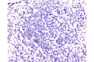 IHC analysis of RPS3 using anti-RPS3 antibody (ABIN6719371). (RPS3 Antikörper)