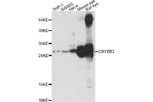 Western blot analysis of extracts of various cell lines,ing CRYBB2 antibody (ABIN5969861) at 1/1000 dilution.